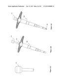 Tools and Systems for Solid Form and Graft Implantation diagram and image