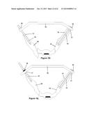 Method and Apparatus for Minimally Invasive Treatment of Unstable Pelvic     Ring Injuries Combined with Hip Arthroplasty diagram and image