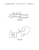 Magnetically guided catheters diagram and image