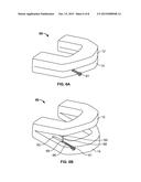 METHODS AND MATERIALS FOR ORAL STENTING diagram and image