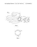 METHODS AND MATERIALS FOR ORAL STENTING diagram and image