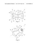 PESSARY DEVICE WITH LONGITUDINAL FLEXIBILITY diagram and image