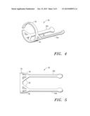 Reinforced Prosthetic Tissue Valves diagram and image