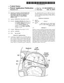 Devices, Systems, and Methods for Reshaping a Heart Valve Annulus,     Including the Use of a Bridge Implant Having an Adjustable Bridge Stop diagram and image