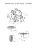 Devices, Systems, and Methods for Reshaping a Heart Valve Annulus,     Including the Use of a Bridge Implant Having an Adjustable Bridge Stop diagram and image