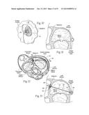 Devices, Systems, and Methods for Reshaping a Heart Valve Annulus,     Including the Use of a Bridge Implant Having an Adjustable Bridge Stop diagram and image