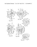 Devices, Systems, and Methods for Reshaping a Heart Valve Annulus,     Including the Use of a Bridge Implant Having an Adjustable Bridge Stop diagram and image