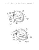 Devices, Systems, and Methods for Reshaping a Heart Valve Annulus,     Including the Use of a Bridge Implant Having an Adjustable Bridge Stop diagram and image