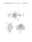 PERCUTANEOUS IMPLANT diagram and image