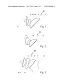 SHOULDER PROSTHESIS AND COMPONENTS THEREOF diagram and image