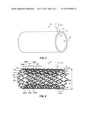 High Visibility Endoprosthesis and Method diagram and image