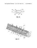 High Visibility Endoprosthesis and Method diagram and image