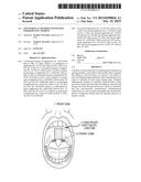 Non-Surgical Method and System for Reducing Snoring diagram and image