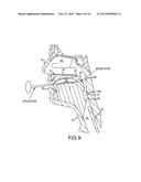 Non-Surgical Method and System for Reducing Snoring diagram and image