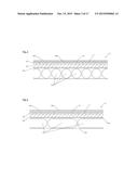 Underbody Supports with Patient Securing Features diagram and image