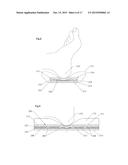 Underbody Supports with Patient Securing Features diagram and image