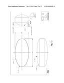 Microporous Zirconium Silicate for the Treatment of Hyperkalemia diagram and image