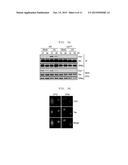 ADMINISTRATION METHOD FOR ANTICANCER DRUGS diagram and image