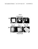 Solution Blow Spun Polymer Fibers, Polymer Blends Therefor and Methods of     Use Thereof diagram and image