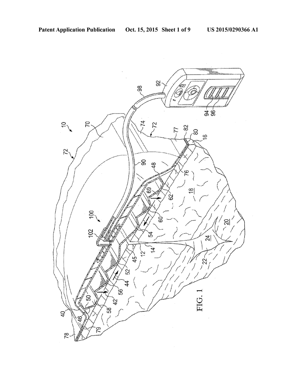 Reduced-Pressure Dressing Assemblies For Use In Applying A Closing Force - diagram, schematic, and image 02