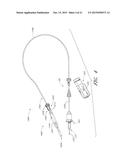 CATHETER PUMP WITH ACCESS PORTS diagram and image