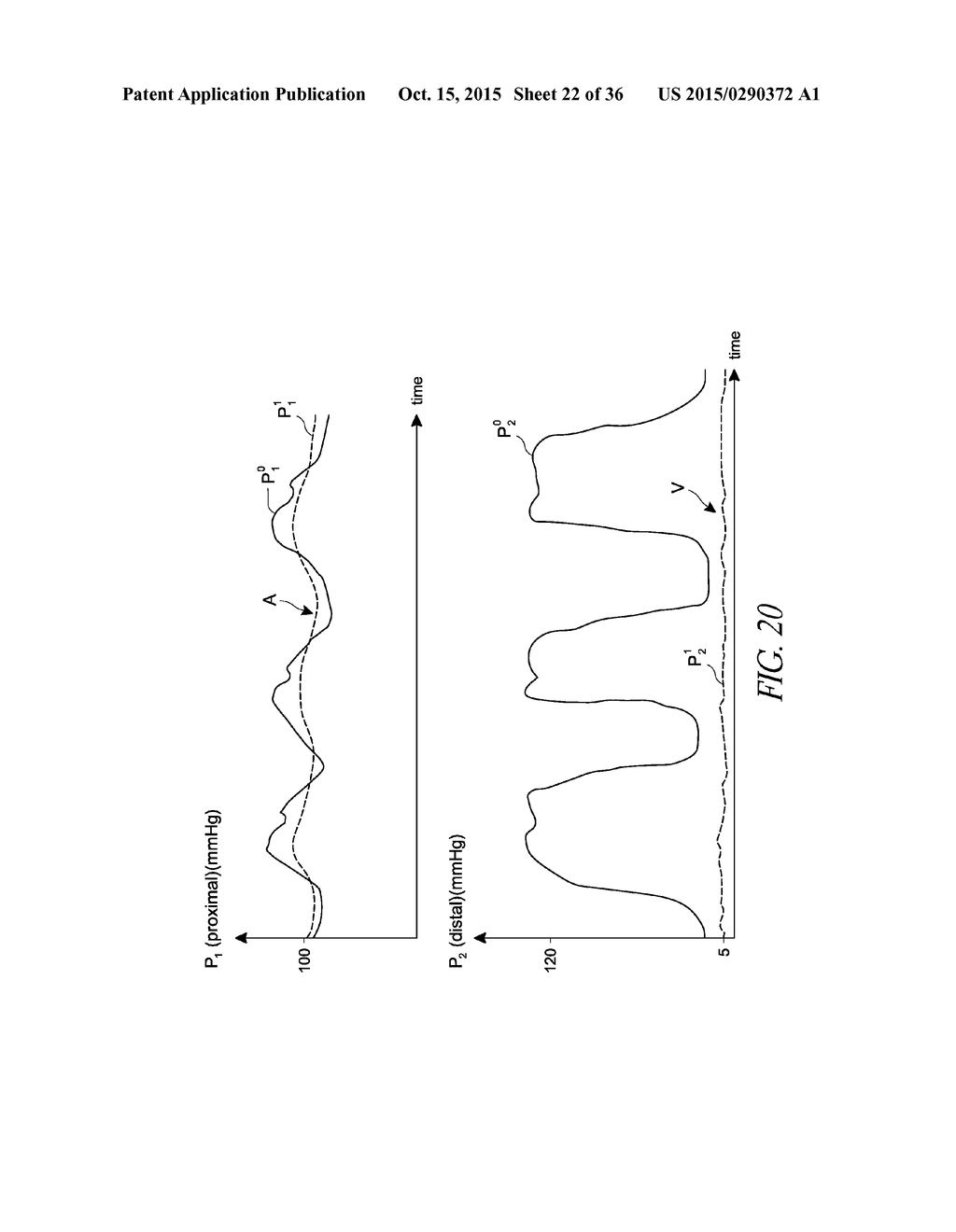 SENSORS FOR CATHETER PUMPS - diagram, schematic, and image 23