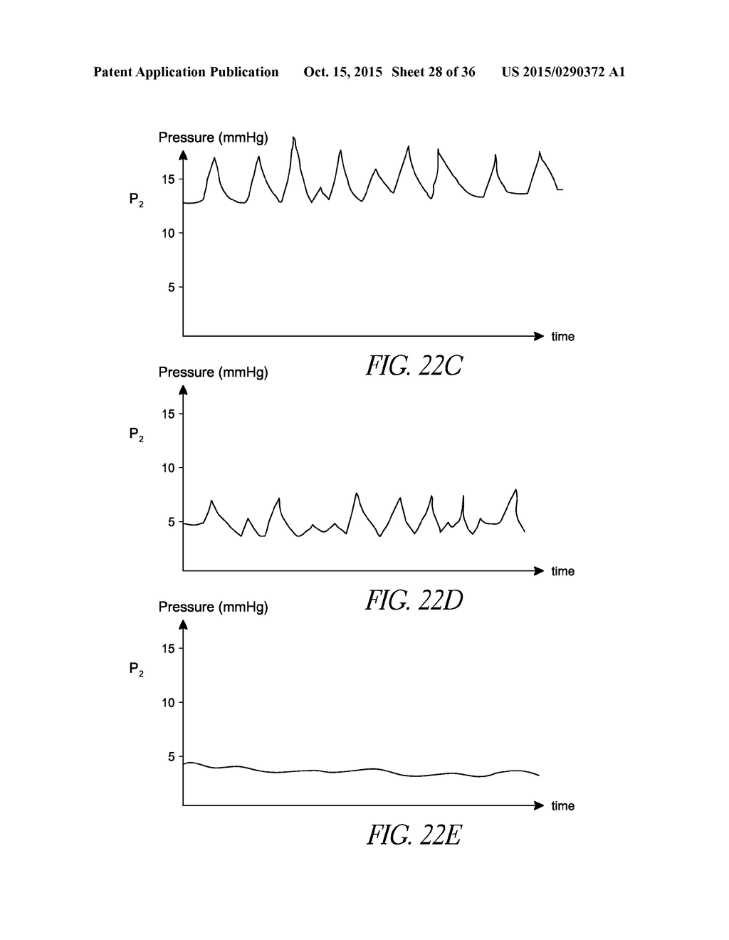 SENSORS FOR CATHETER PUMPS - diagram, schematic, and image 29