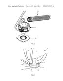 METHODS AND SYSTEMS FOR UPGRADING VENTRICLE ASSIST DEVICES diagram and image