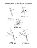 DIALYSIS CATHETER diagram and image