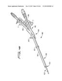 DIALYSIS CATHETER diagram and image