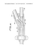 DIALYSIS CATHETER diagram and image