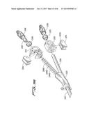 DIALYSIS CATHETER diagram and image