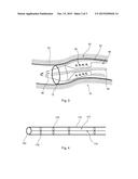 INTRODUCER ASSEMBLY AND PROTECTIVE SLEEVE THEREFOR diagram and image