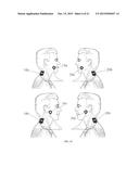 ELECTRICAL STIMULATION DEVICE AND METHOD FOR THE TREATMENT OF NEUROLOGICAL     DISORDERS diagram and image