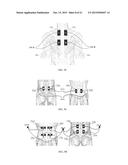 ELECTRICAL STIMULATION DEVICE AND METHOD FOR THE TREATMENT OF NEUROLOGICAL     DISORDERS diagram and image