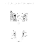 ELECTRICAL STIMULATION DEVICE AND METHOD FOR THE TREATMENT OF NEUROLOGICAL     DISORDERS diagram and image