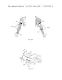 ELECTRICAL STIMULATION DEVICE AND METHOD FOR THE TREATMENT OF NEUROLOGICAL     DISORDERS diagram and image