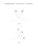 ELECTRICAL STIMULATION DEVICE AND METHOD FOR THE TREATMENT OF NEUROLOGICAL     DISORDERS diagram and image