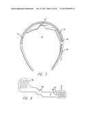 Hybrid Fitting for a Visual Prosthesis diagram and image