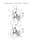 LIGHT THERAPY BANDAGE SYSTEM diagram and image