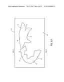 FOOTWEAR UPPER COMPONENTS HAVING CONTOURED FOAM REGIONS AND METHODS OF     FORMING SUCH COMPONENTS diagram and image