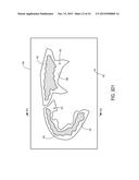 FOOTWEAR UPPER COMPONENTS HAVING CONTOURED FOAM REGIONS AND METHODS OF     FORMING SUCH COMPONENTS diagram and image