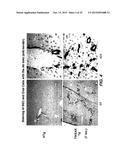 Methods For Treating Tweak-Related Conditions diagram and image