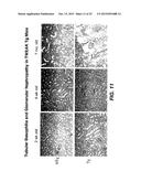 Methods For Treating Tweak-Related Conditions diagram and image