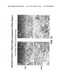 Methods For Treating Tweak-Related Conditions diagram and image