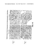 Methods For Treating Tweak-Related Conditions diagram and image