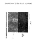 Methods For Treating Tweak-Related Conditions diagram and image