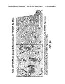 Methods For Treating Tweak-Related Conditions diagram and image