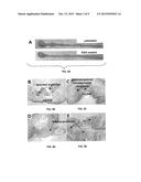 Materials and Methods Related to NSAID Chemoprevention in Colorectal     Cancer diagram and image