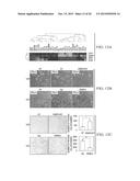 METHODS OF CHARACTERIZING AND TREATING MOLECULAR SUBSET OF MUSCLE-INVASIVE     BLADDER CANCER diagram and image